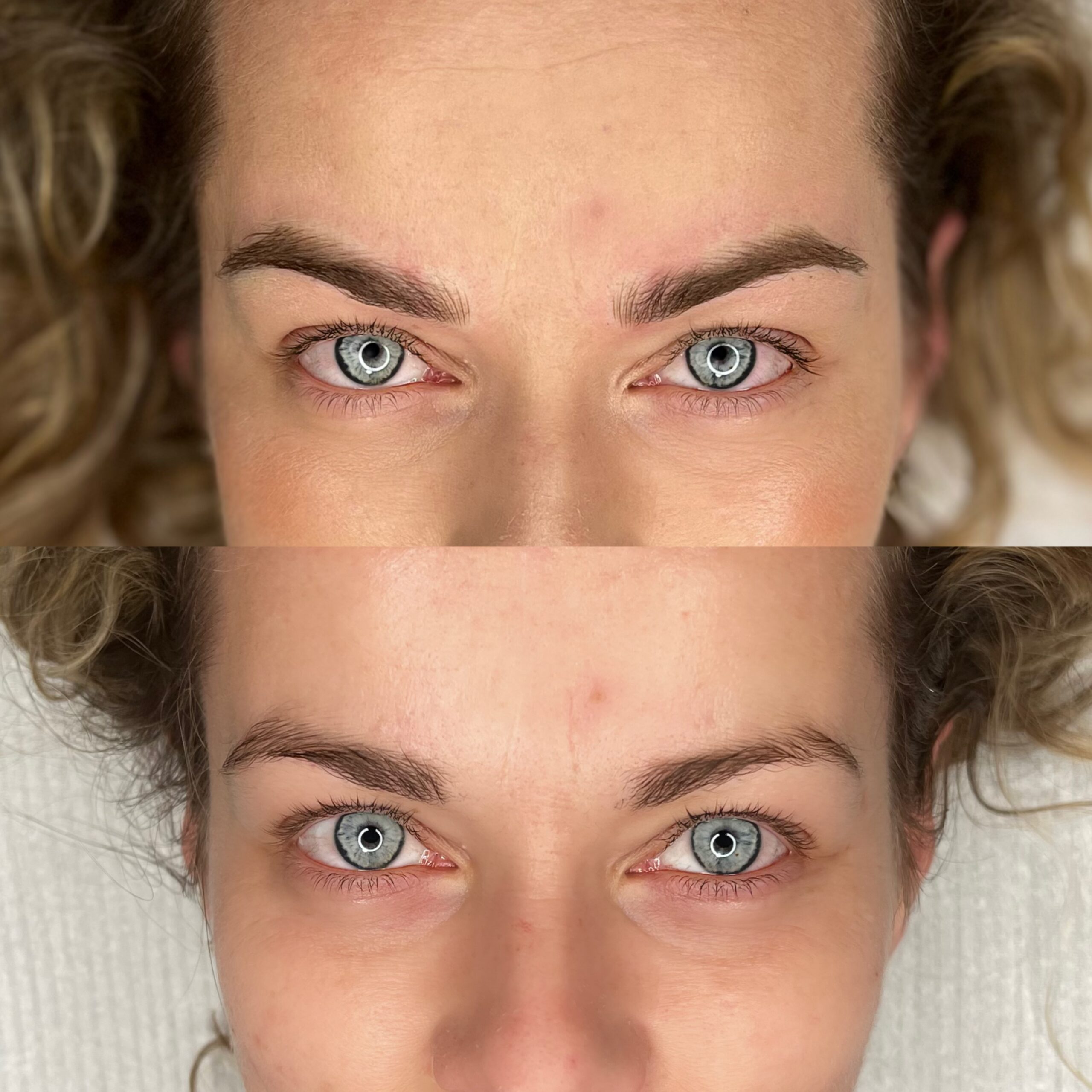 brwi metoda wlosa maszynowego